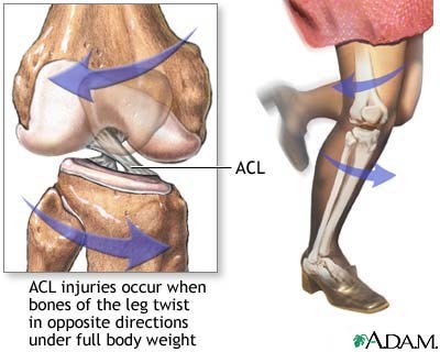 ACL2