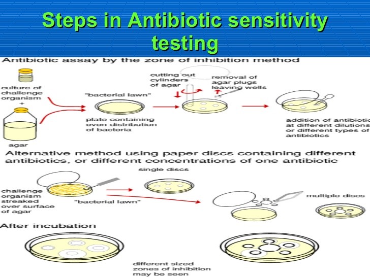 ANTIBIOTIC