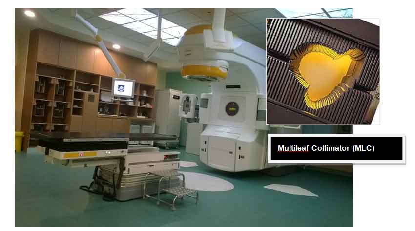 Intensity Modulated Radiation Therapy Imrt Portal Myhealth 8873