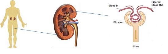 membranous nephropathy