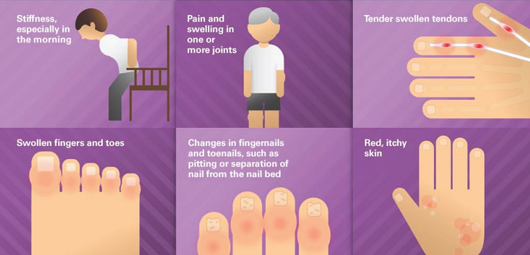 Psoriatic Arthritis - PORTAL MyHEALTH